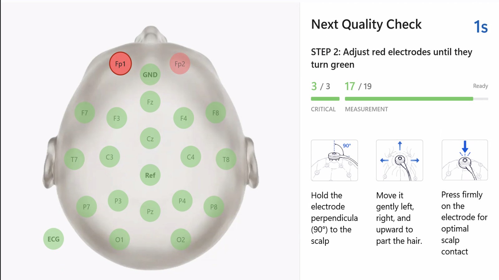 Brainify.AI software guiding an operator through electrode quality checks