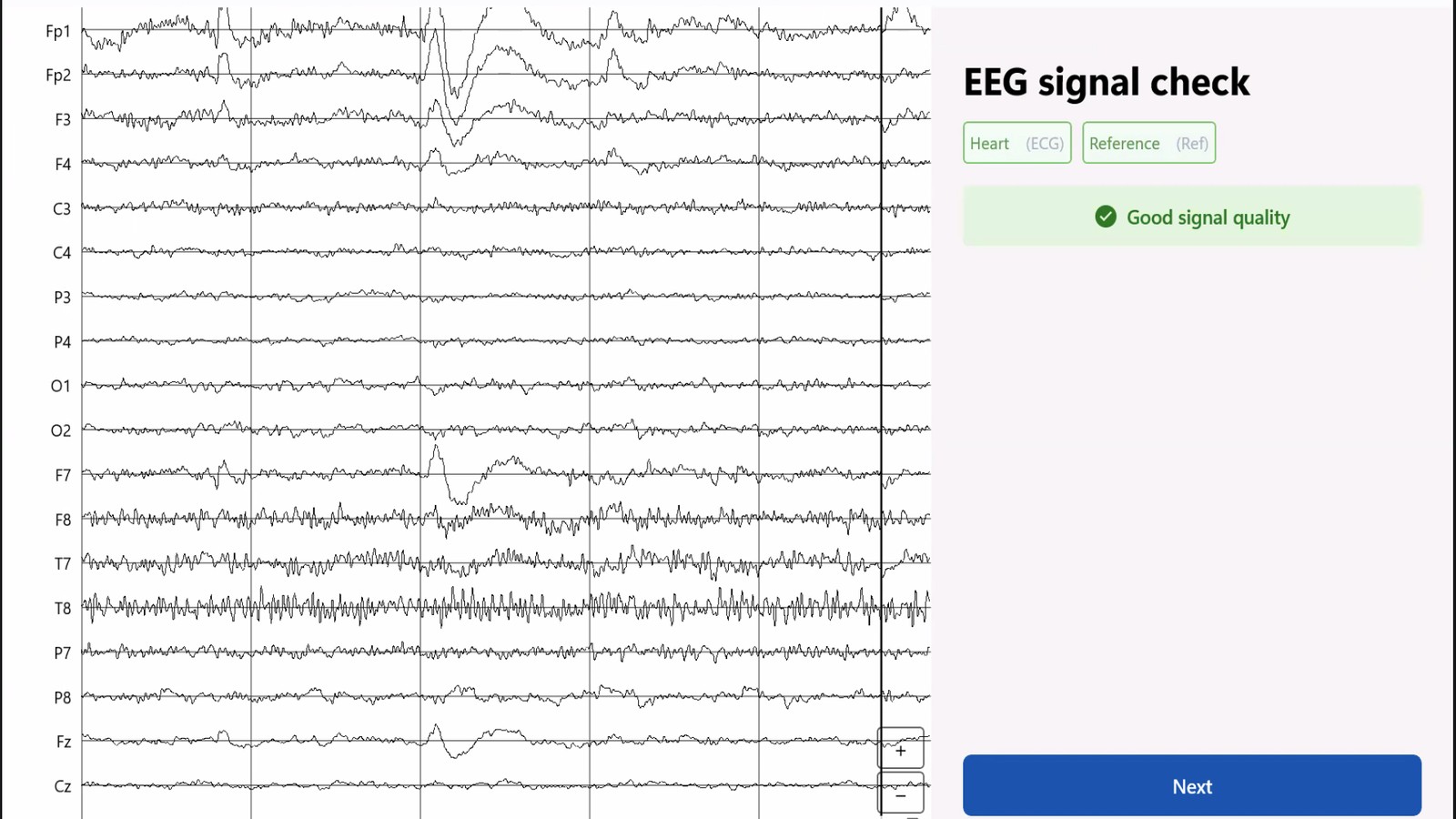 Brainify.AI EEG signal-quality screen showing a successful check